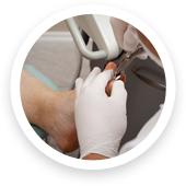 belleville podiatrist for ingrown toenail treatment